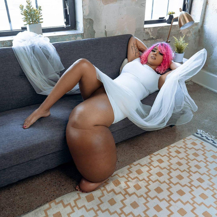 Mang một bên chân nặng 45kg, cô gái vượt đau đớn tự tin trở thành người mẫu - 2