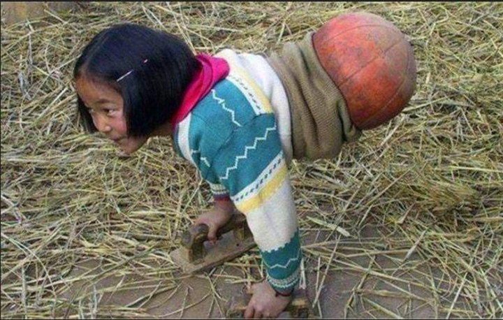 ‘Cô bé bóng rổ’ bị mất nửa người từng gây sốt ngày ấy giờ đây còn đáng nể hơn - 2
