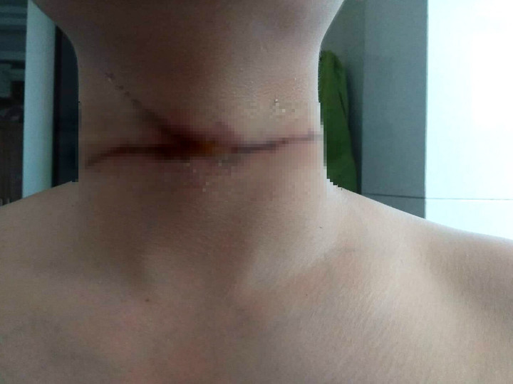 Chàng trai chia sẻ sự cố trời giáng từ dây diều khiến dân mạng rùng mình - 1