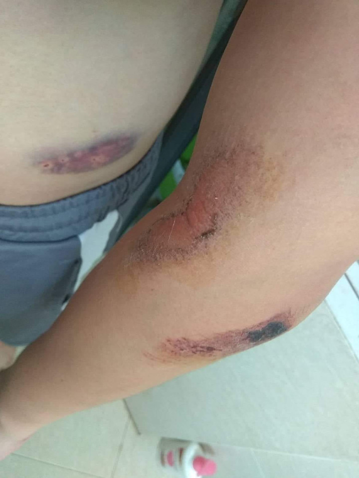 Chàng trai chia sẻ sự cố trời giáng từ dây diều khiến dân mạng rùng mình - 2