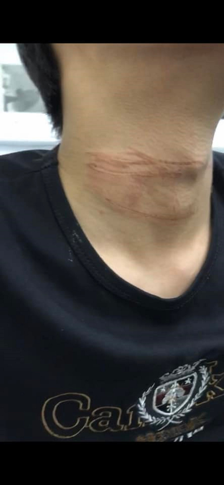 Chàng trai chia sẻ sự cố trời giáng từ dây diều khiến dân mạng rùng mình - 4