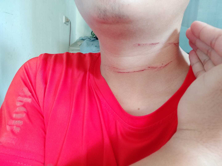 Chàng trai chia sẻ sự cố trời giáng từ dây diều khiến dân mạng rùng mình - 3