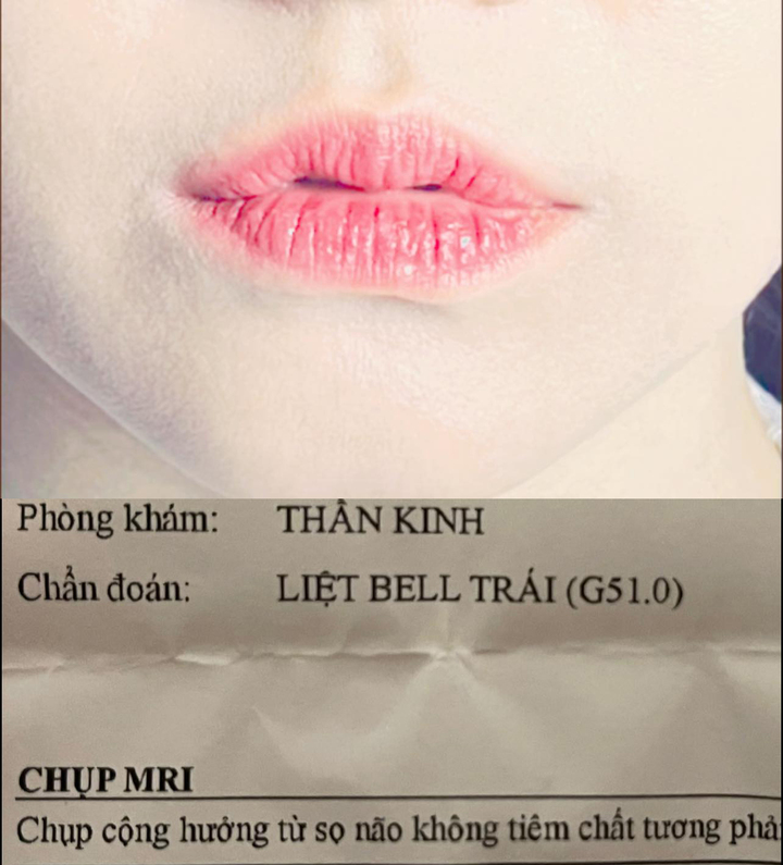 Sao Việt 3/8: Hari Won bị liệt cơ mặt bên trái - 1