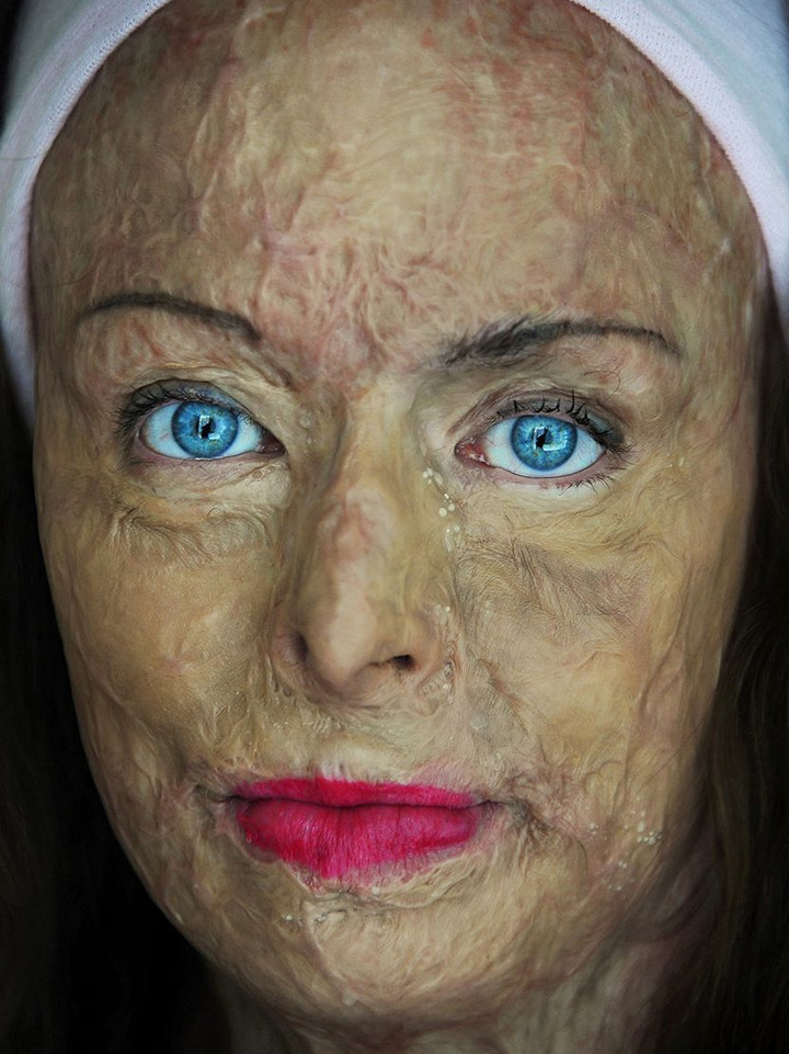 Hành trình tìm lại sự ‘sống’ của cựu hoa hậu bị bỏng gần hết cơ thể sau đám cháy - 3