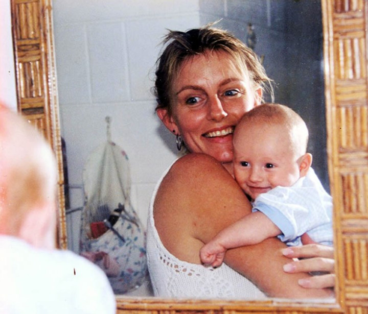 Hành trình tìm lại sự ‘sống’ của cựu hoa hậu bị bỏng gần hết cơ thể sau đám cháy - 1