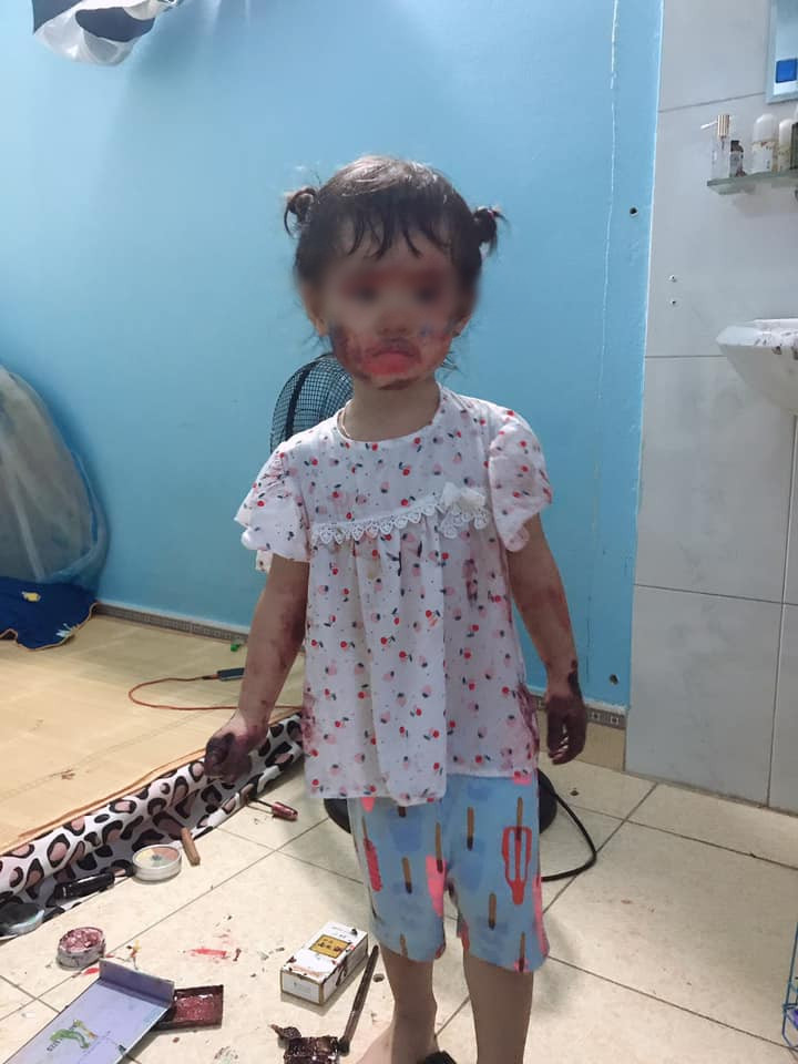 Loạt trò nghịch hú hồn của trẻ con làm bố mẹ '3 phần đau đớn, 7 phần gục ngã' - 6