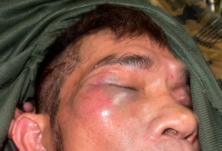 Ca sĩ Chế Phi say xỉn, bị đánh hội đồng tại sảnh thang máy chung cư - 2