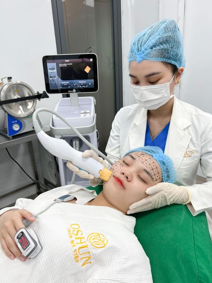 Ultherapy & Thermage FLX - Công nghệ trẻ hóa xóa nhăn, căng da tức thì - 4