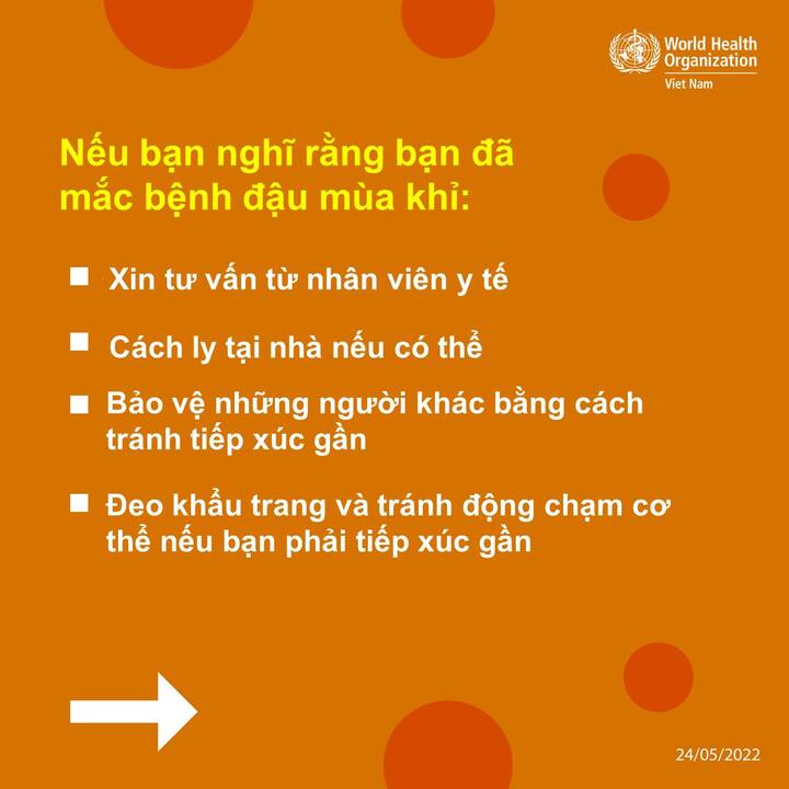 Bạn có thể mắc bệnh đậu mùa khỉ vì những lý do này - 5