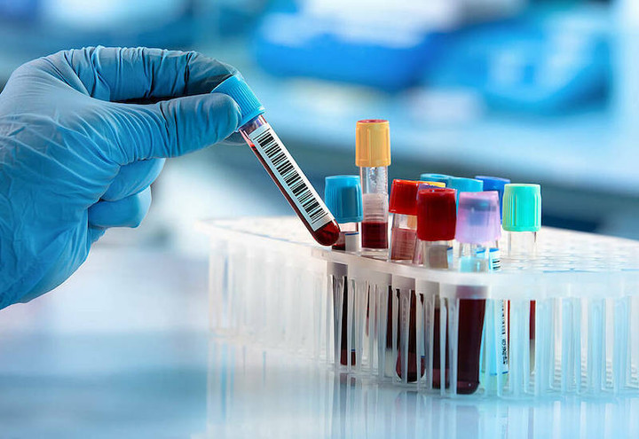 Những dấu hiệu cảnh báo bệnh ung thư máu, bạn nhất định không được bỏ qua - 1