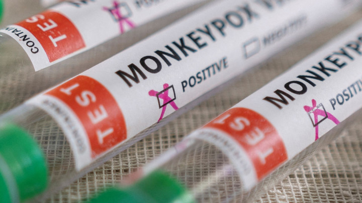 6 nguyên tắc kiểm soát lây nhiễm bệnh đậu mùa khỉ trong cơ sở y tế - 1