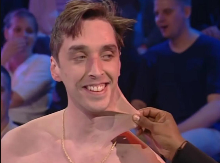 Người đàn ông có ‘làn da cao su’ kéo giãn tùy thích, 20 năm qua chưa có đối thủ - 1