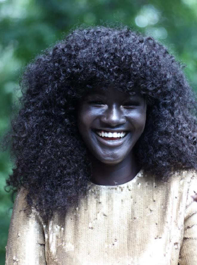 Cô gái từng bị bắt nạt vì làn da đen độc đáo bất ngờ thành danh nhờ đặc điểm này - 1