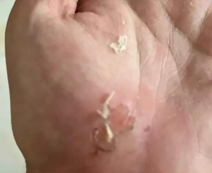 Chàng trai tức giận vì bị ô tô tông ngã nhưng nín nhịn khi biết danh tính tài xế - 3