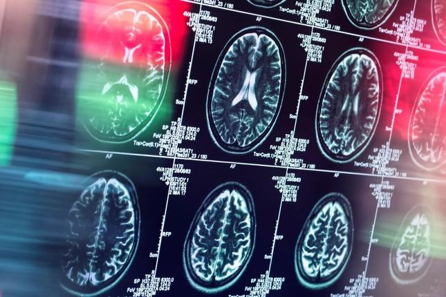 Gặp ác mộng ở tuổi trung niên: Dấu hiệu sớm cảnh báo căn bệnh nguy hiểm - 1