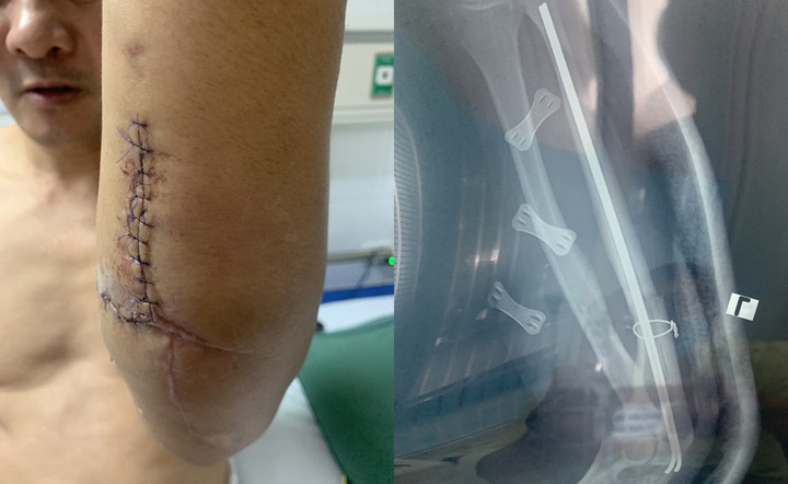 Đi tìm kẻ nhắn tin gạ tình vợ, người đàn ông ở Hải Phòng bị chém trọng thương - 1