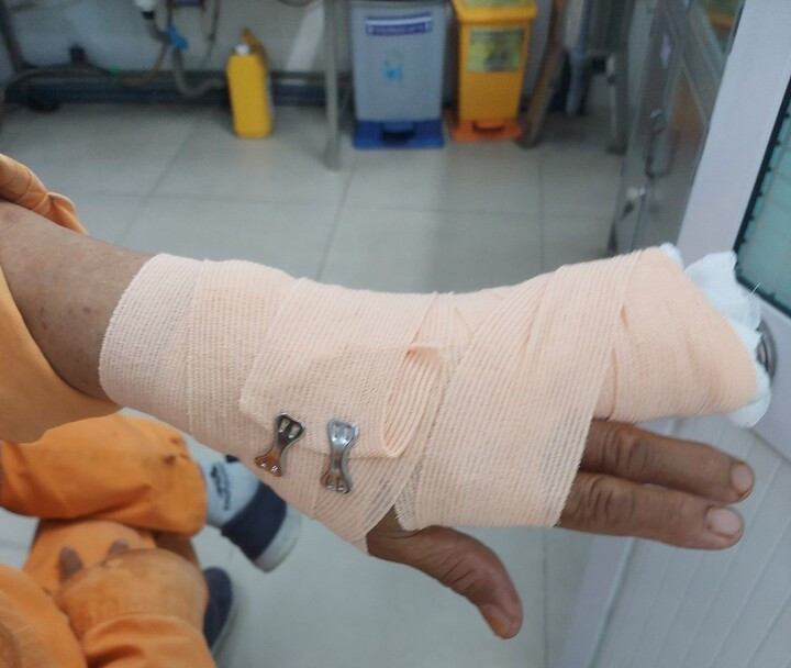 Đi nhắc nợ, nhân viên điện lực ở TP.HCM bị khách hàng đánh nhập viện - 1