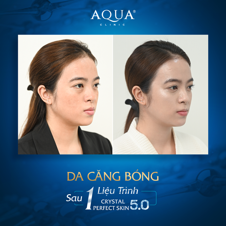 Aqua Clinic ra mắt công nghệ căng bóng da hiện đại bậc nhất - 2