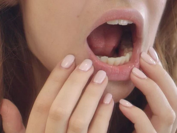 Bị khô miệng kéo dài gây hại thế nào với sức khỏe? - 1