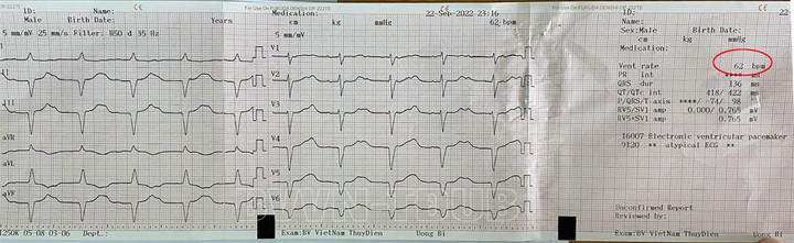 Đặt máy tạo nhịp tim cứu sống cụ ông 96 tuổi - 1