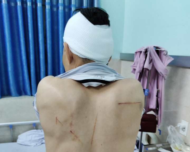 Khởi tố nhóm côn đồ chém người đàn ông trước cổng bệnh viện ở Hải Phòng - 2