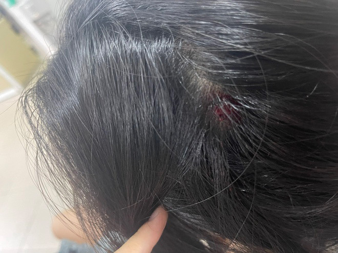 Điều tra vụ người phụ nữ mang thai bị hành hung ở Hải Phòng - 2