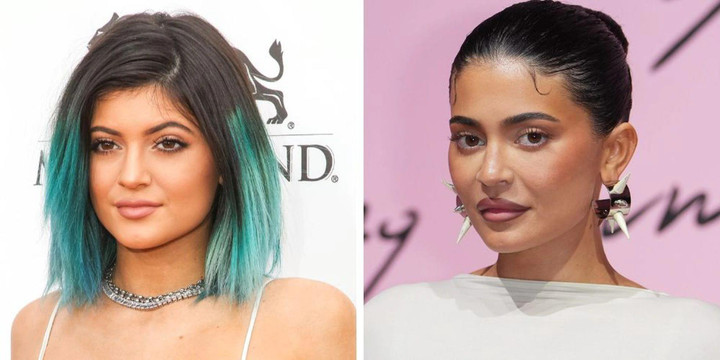 Kylie Jenner khiến dân mạng giận dữ khi tự nhận mình 'đẹp tự nhiên' - 2
