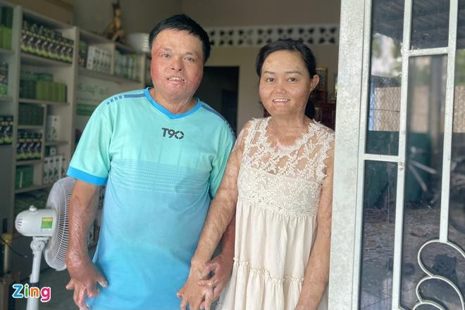 Người phụ nữ từng bị chồng cũ thiêu sống hạnh phúc bên người mới - 2