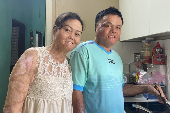 Người phụ nữ từng bị chồng cũ thiêu sống hạnh phúc bên người mới - 4