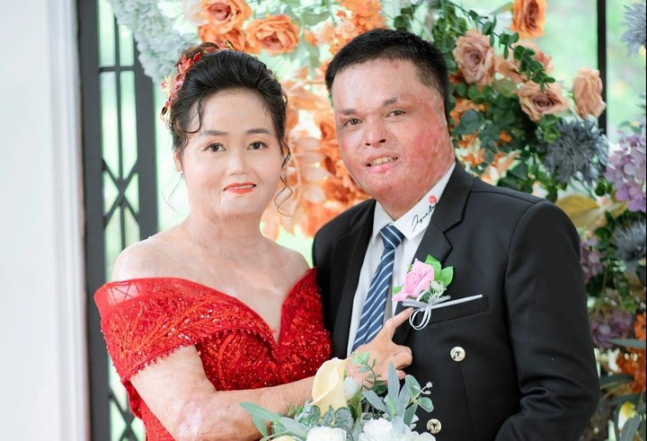 Người phụ nữ từng bị chồng cũ thiêu sống hạnh phúc bên người mới - 1
