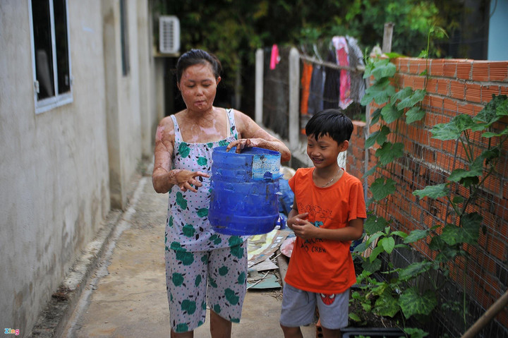 bị chồng thiêu sống ảnh 4 Người phụ nữ từng bị chồng cũ thiêu sống hạnh phúc bên người mới - 5