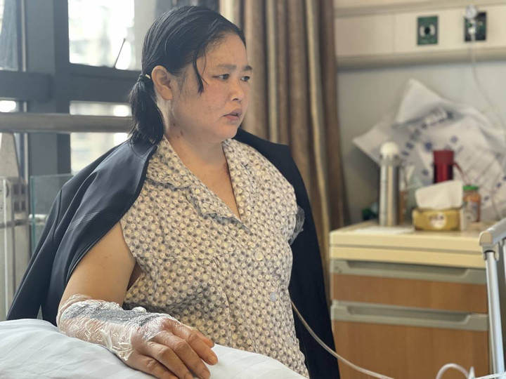 Lao ra cứu bé trai trước đầu xe tải, người phụ nữ bị cắt cụt mất một tay - 1