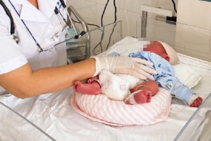 Bé gái vừa chào đời da đỏ tía toàn thân - 1