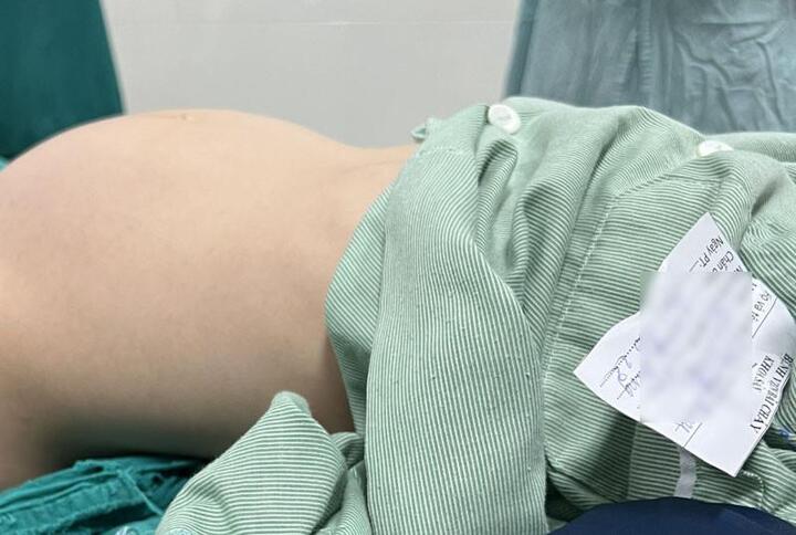Bé gái 12 tuổi đi khám vì bụng to bất thường - 1