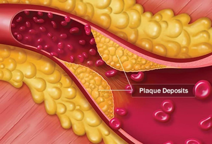 Điều gì xảy ra với cơ thể bạn ở tuổi ngoài 50? - 3