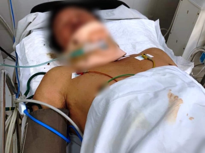 Va chạm với xe ba gác, người đàn ông ở Quảng Nam bị tôn cắt trúng cổ - 1