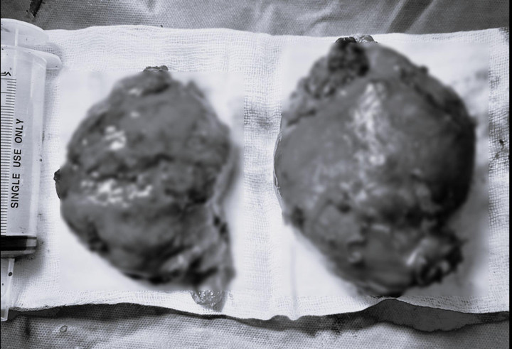 Đau âm ỉ hông lưng, người đàn ông phát hiện bệnh hiếm gặp - 1