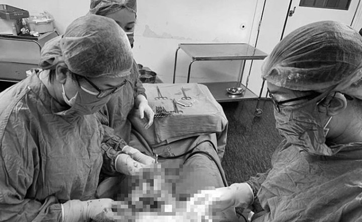 Hiếm gặp: Sản phụ mang thai đôi ở hai tử cung khác nhau - 1