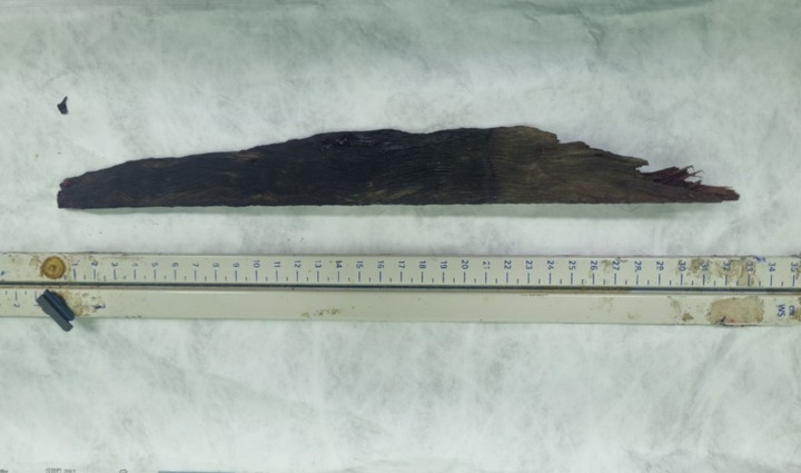 8 bác sĩ phối hợp cứu sống nam thanh niên bị thanh gỗ 30cm đâm xuyên phổi - 1