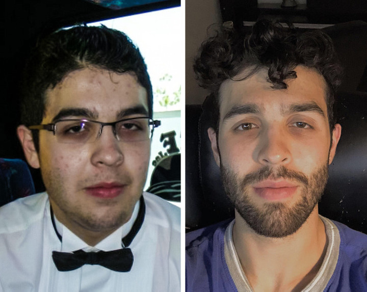 Những màn 'dậy thì thành công' gây ngỡ ngàng, nhìn cứ tưởng là 2 người khác nhau - 7