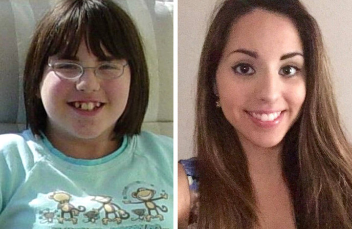 Những màn 'dậy thì thành công' gây ngỡ ngàng, nhìn cứ tưởng là 2 người khác nhau - 5