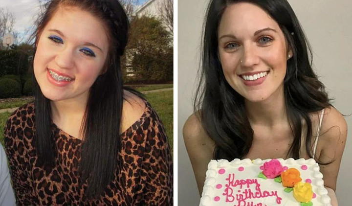 Những màn 'dậy thì thành công' gây ngỡ ngàng, nhìn cứ tưởng là 2 người khác nhau - 2