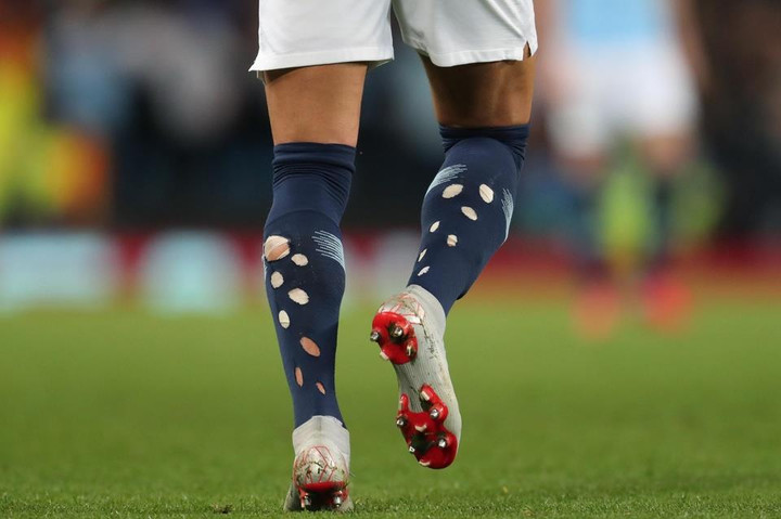 Vì sao các cầu thủ Anh mang tất thủng lỗ chỗ tại World Cup 2022? - 1