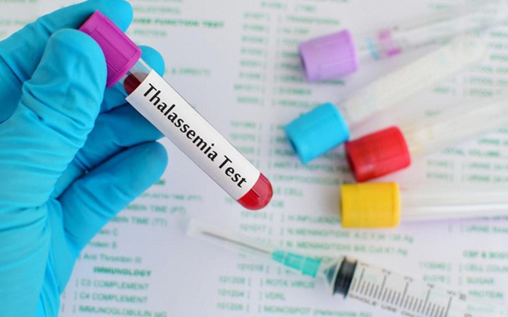 Bố mẹ nên làm gì để phòng bệnh Thalassemia cho con? - 1