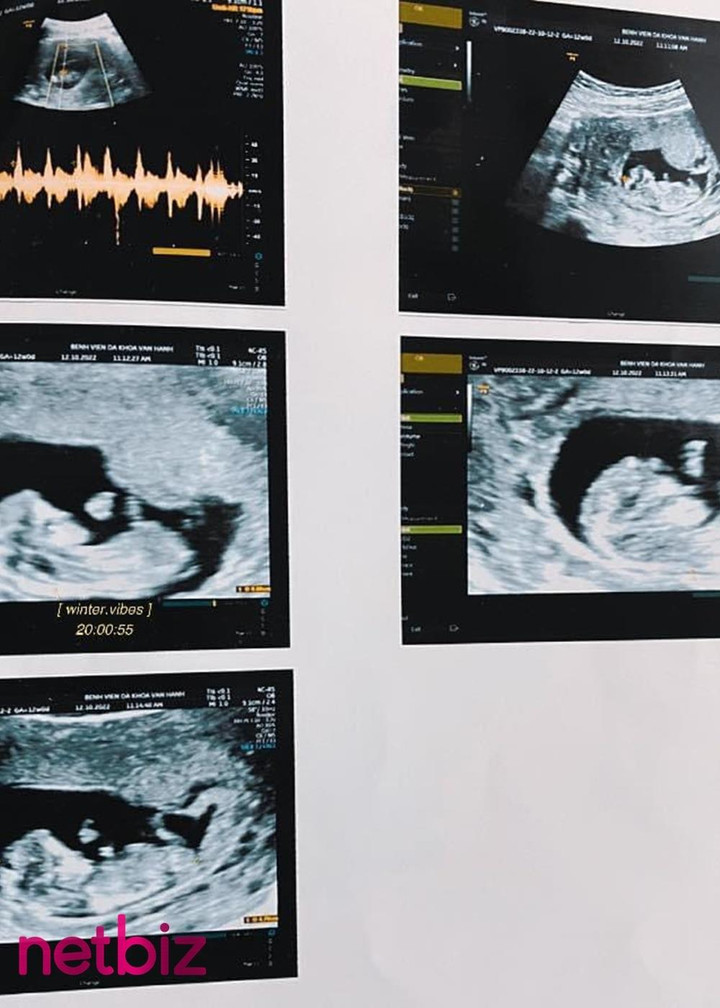 Đôi vợ chồng trẻ đón 'tin vui' sau lời chúc của 'ông mụ' Quốc Thuận và Hồng Vân - 7