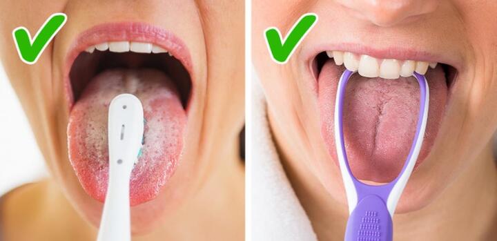 Bạn có đang vệ sinh răng miệng sai cách? - 2