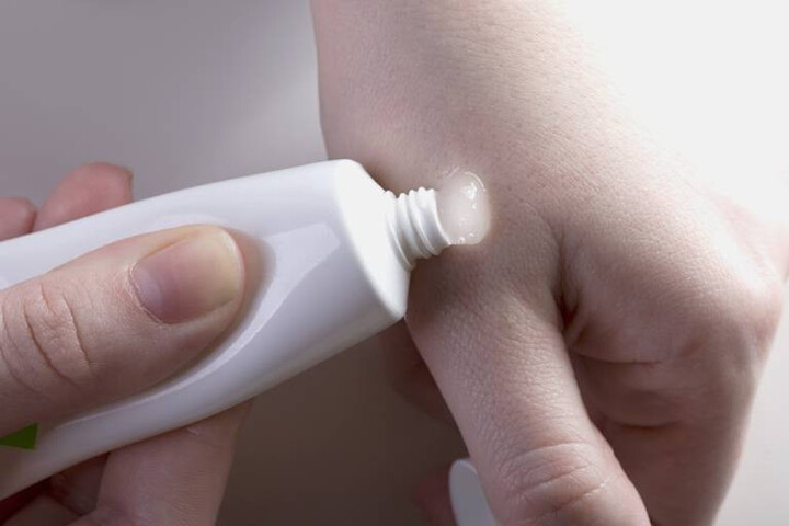 Nhiễm trùng nặng vì trị nám bằng thuốc chứa axit - 1