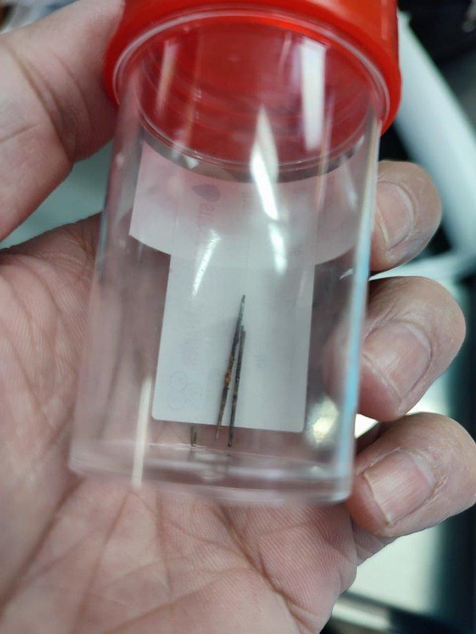 Bác sĩ kịp thời gắp kim may quần áo trong phổi bé trai 4 tuổi - 2