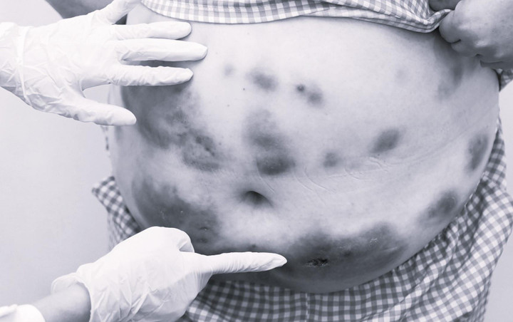 Thẩm mỹ viện biến mất sau khi khách hàng bị tai biến tiêm tan mỡ - 1