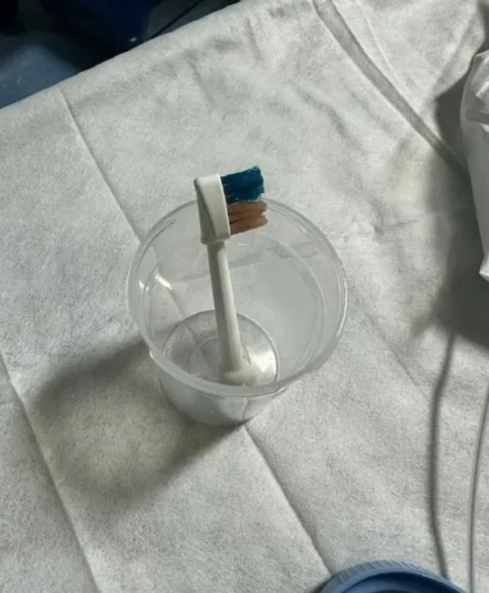 Bác sĩ sửng sốt phát hiện đầu bàn chải điện bên trong bụng cậu bé 9 tuổi - 1